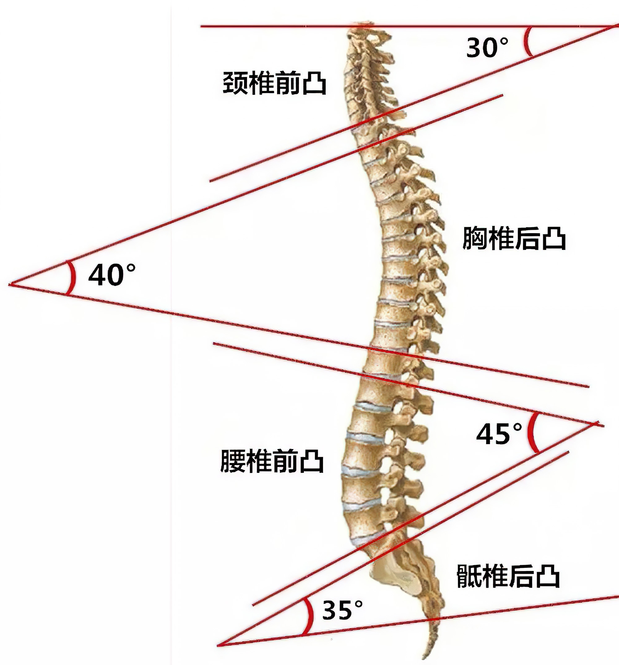 腰椎生理性曲度变直怎么治疗恢复,如何有效的避免腰椎曲度变直