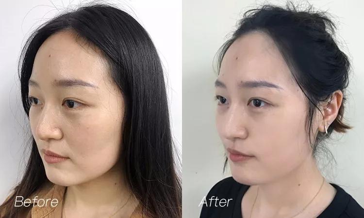 有黑头和没黑头有什么区别,没有长过黑头却长黑头怎么办