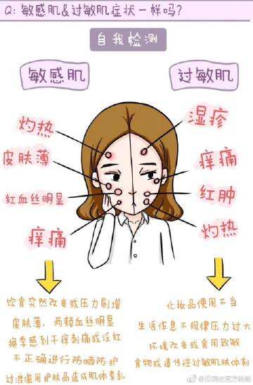脸上皮肤容易过敏什么原因,幼儿皮肤过敏症状图解和原因