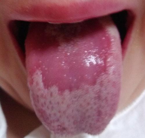 气虚导致的大汗淋漓怎么调,一动就大汗淋漓是体虚吗