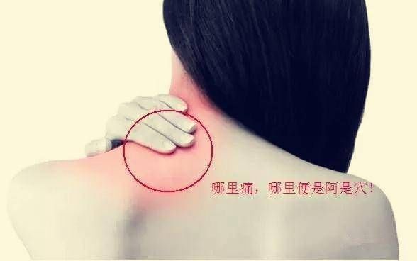 腰扭伤的三步疗法，详细步骤及穴位图，收藏起来吧