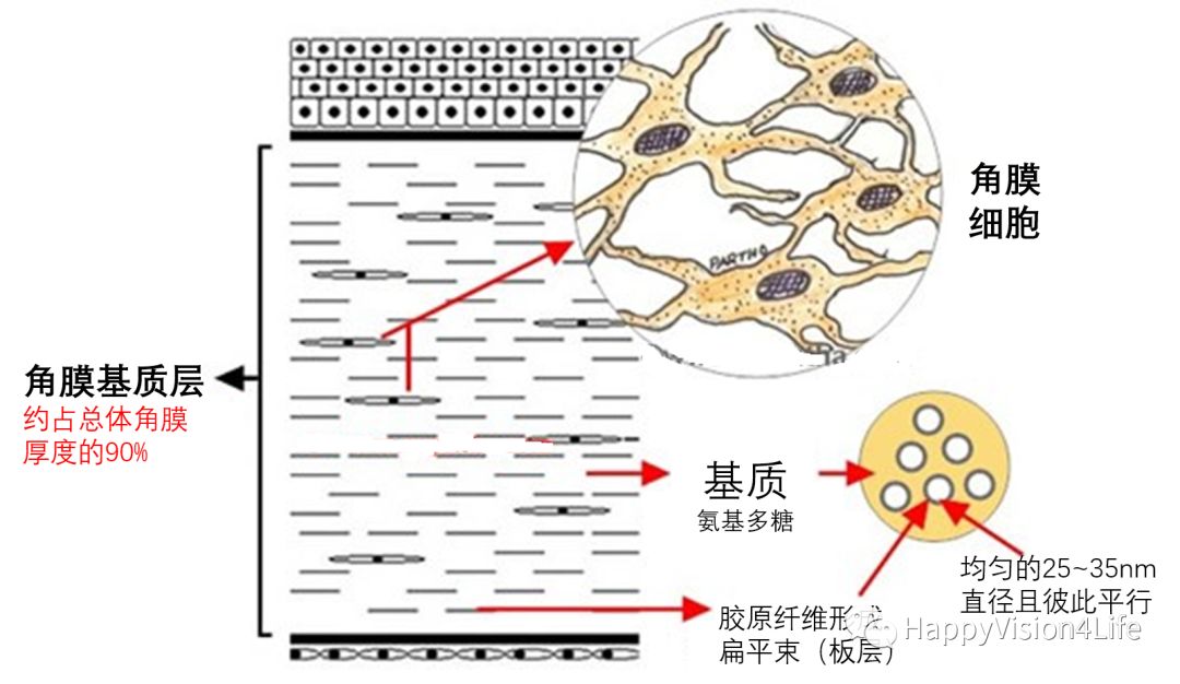 洞察超乳术后角膜的水肿