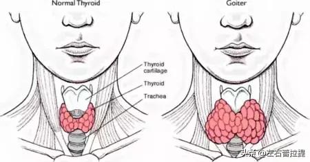 改善乳腺甲状腺功能的瑜伽动作,保护甲状腺的瑜伽动作