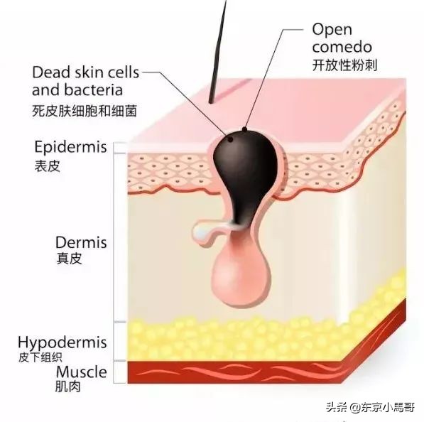 改善毛孔粗大的护肤习惯,可以改善毛孔粗大的护肤方法