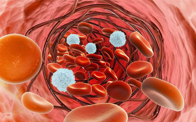 过敏性紫癜怎么办才能彻底好,过敏性紫癜怎么才能不复发