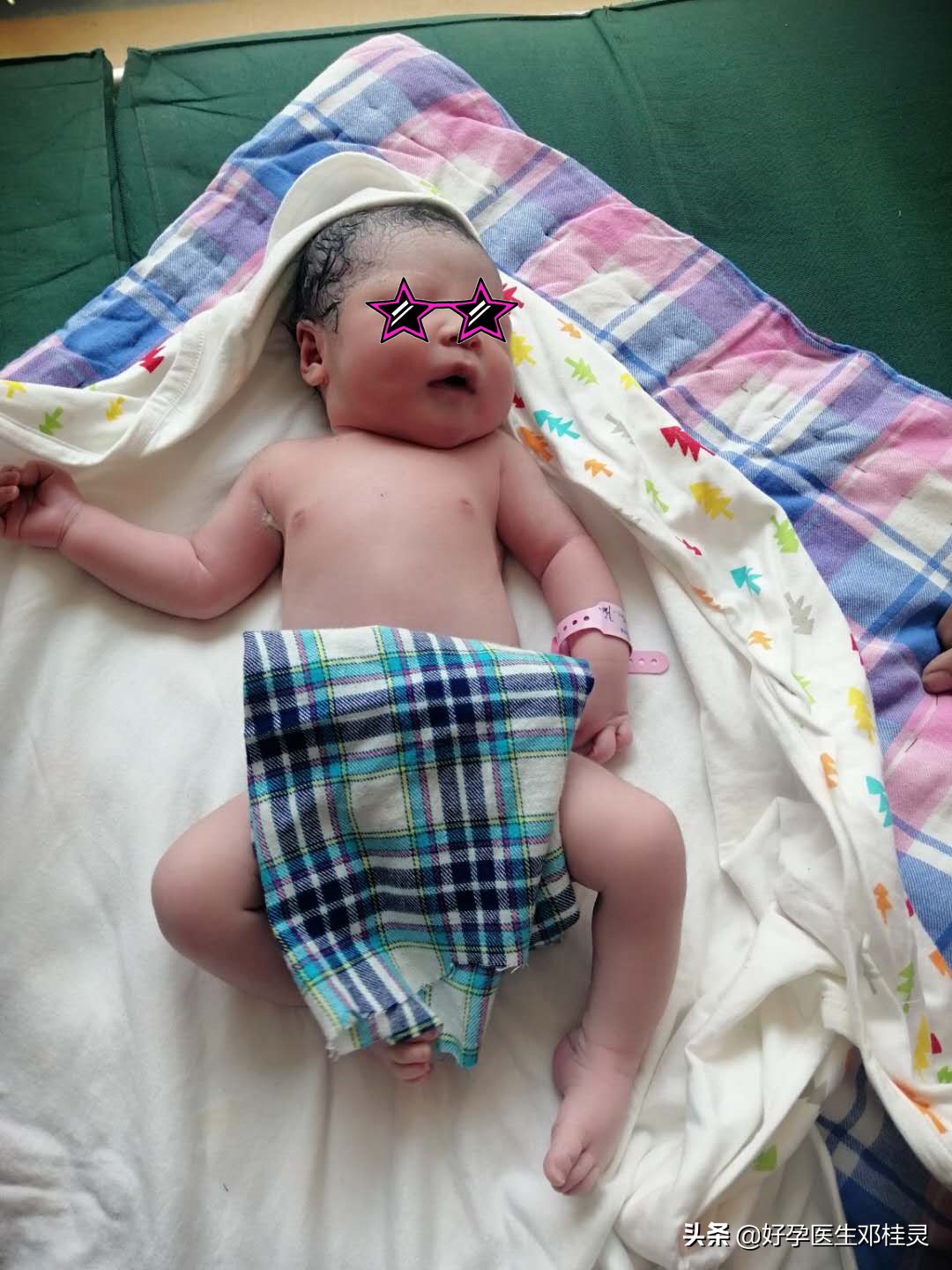 输卵管峡部结扎复通怀孕几率大吗,备孕科普结扎