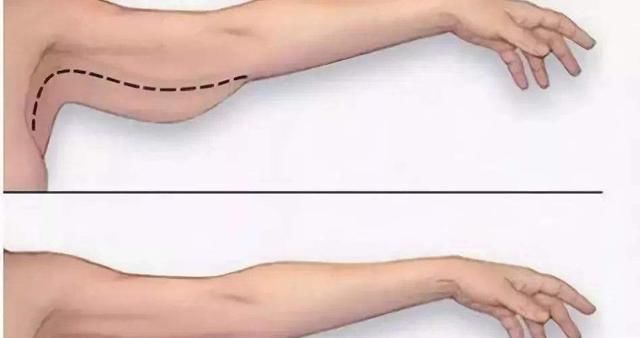 简单有效瘦手臂教你甩掉拜拜肉,快速减掉手臂拜拜肉的动作有哪些