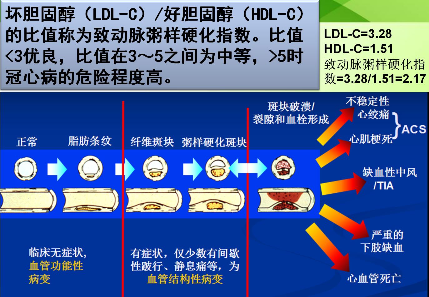 排名第一的降血脂运动,运动锻炼降低血脂最有效的方法