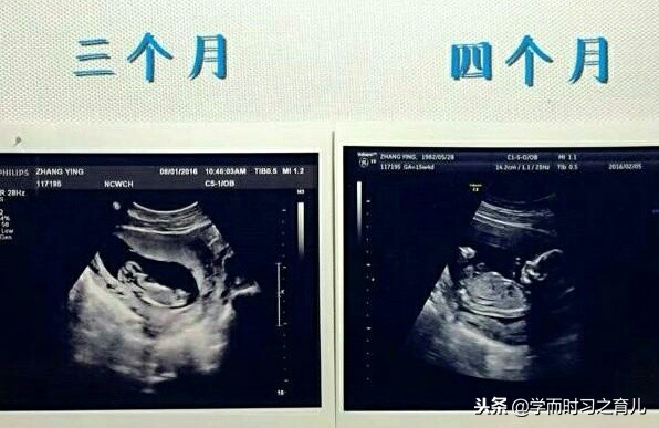 怀孕1到10个月需要注意什么,怀孕期间1-10个月的注意事项