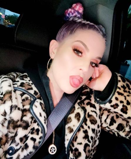 缩胃手术瘦下来案例,肥胖女孩做缩胃手术