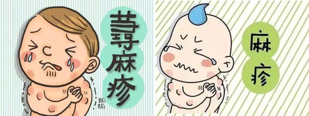 近期儿童流行疾病,儿童常见的疾病预防知识