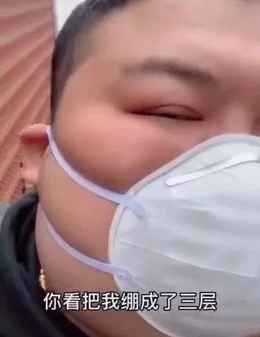 不整容真的能瘦脸吗,瘦脸面膜真的有用吗