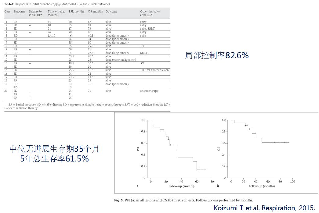孙加源门诊,治疗肺癌的新技术新手段