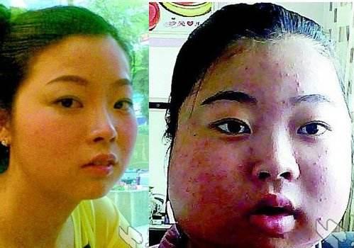 妻子种睫毛后变成面瘫，丈夫想离婚，妻子还沾沾自喜