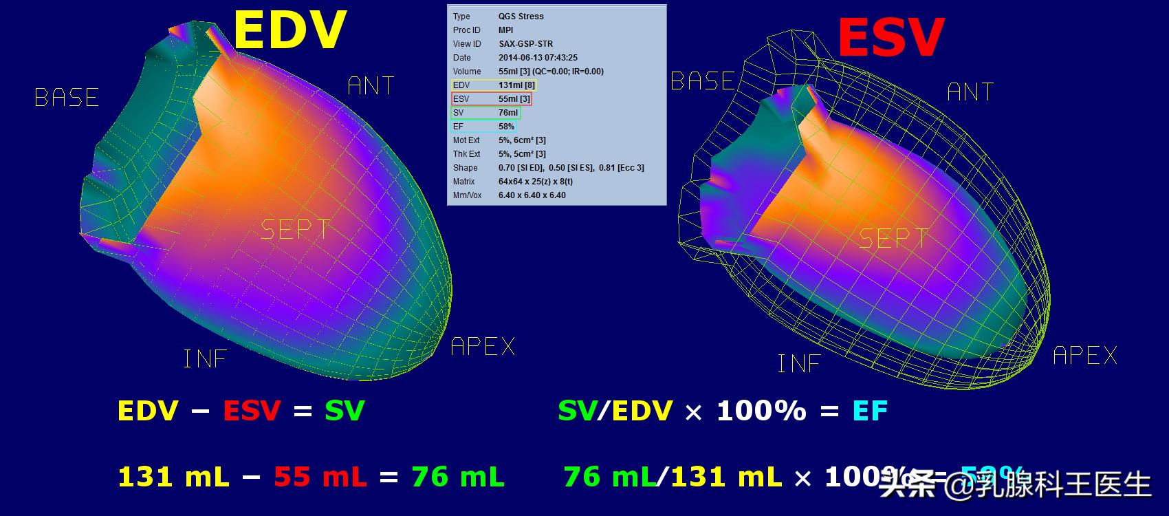 乳腺癌靶向治疗药物对肺癌有效吗,乳腺癌靶向药心脏毒性