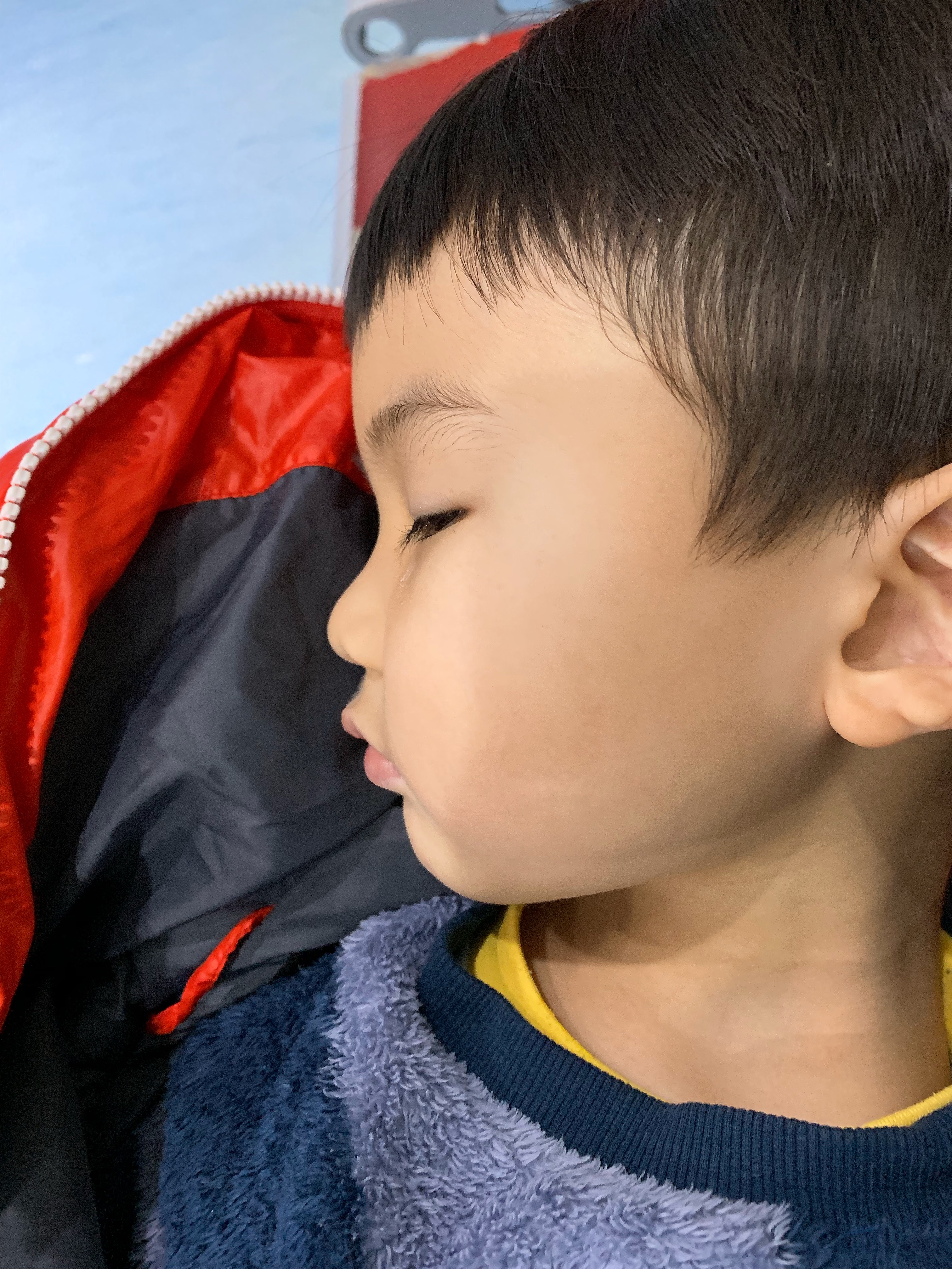 小儿白塞氏病的病因和症状,肉丸子得了什么病