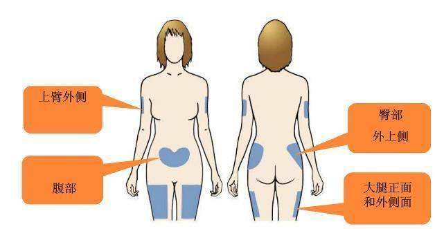 胰岛素注射笔使用方法及注射部位,胰岛素笔的正确使用方式