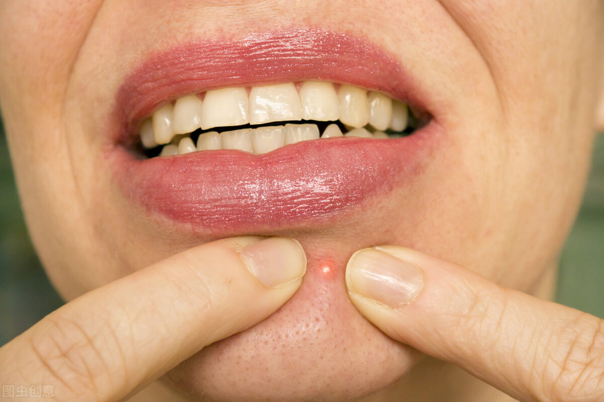 脸上都是痘痘怎么护肤,脸上痘痘比较多怎么保养