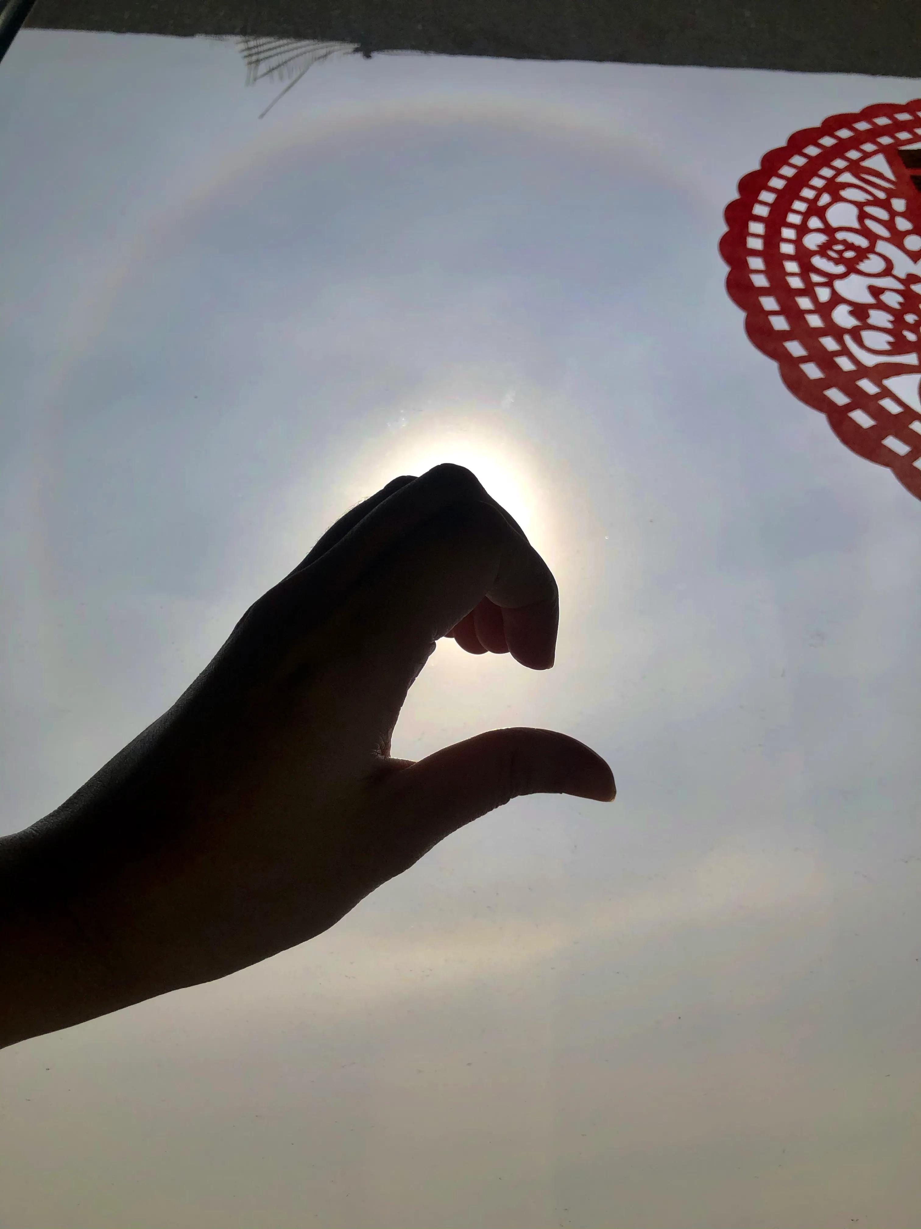 前庭功能障碍是什么原因导致的,前庭功能障碍的最好治疗方法