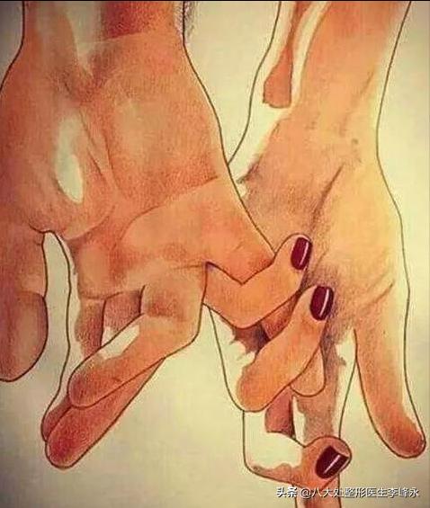 别跟风！网红爆火的“冰冻缩阴”可能是个“巨大的坑”