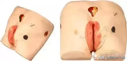 思密达的10种用途,思密达的10种用法