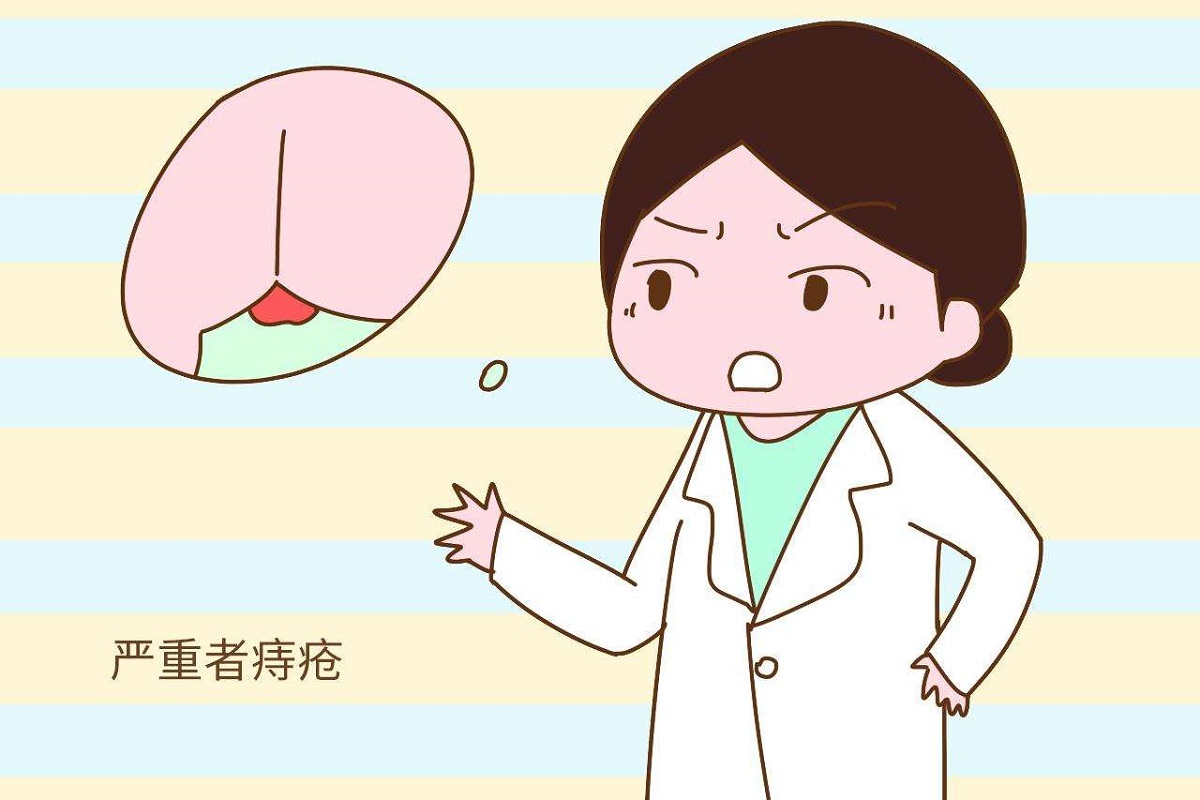 产后出现痔疮是什么原因,产后长内痔疮会复发吗