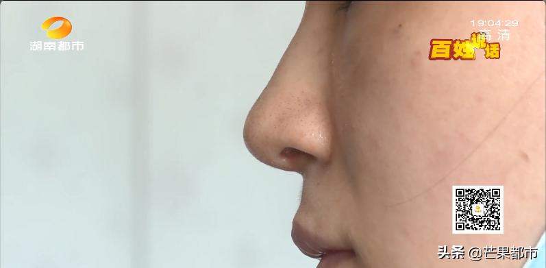 擤鼻涕擤出纱布,擤鼻涕擤出来血块