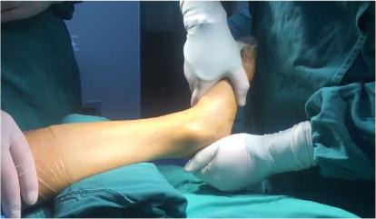 小孩玩多了脚酸脚痛怎么回事,小孩子玩着玩着就脚痛