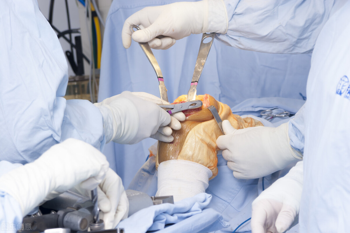 脱肛用什么药有效,大便后脱肛怎么恢复