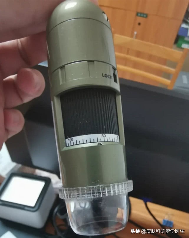 脸上长的痣如果癌变会怎样,最近身上脸上长了很多痣怎么回事