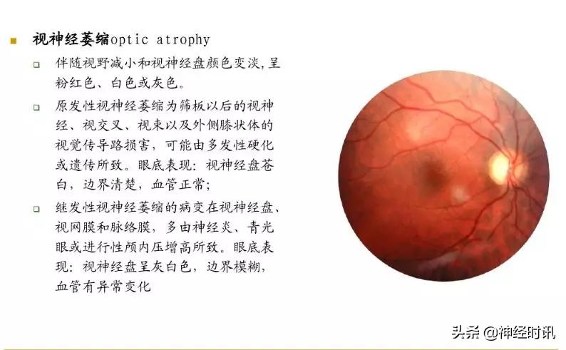 脑神经包含自主神经,脑神经算是传入神经吗