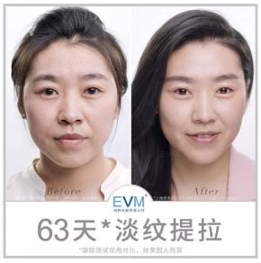 前有迪丽热巴代言，后有郭碧婷喜爱的自然之名、EVM好在哪里？