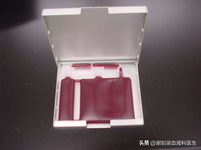 脐带血有用吗能治病吗,脐带血可以治疗先天性缺陷吗