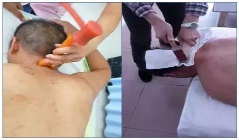 面对颈椎病—如何做个“聪明外行”