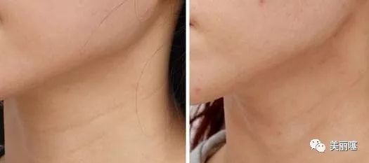 微商卖的大牌化妆品是真的吗,微商卖大牌化妆品为什么那么便宜