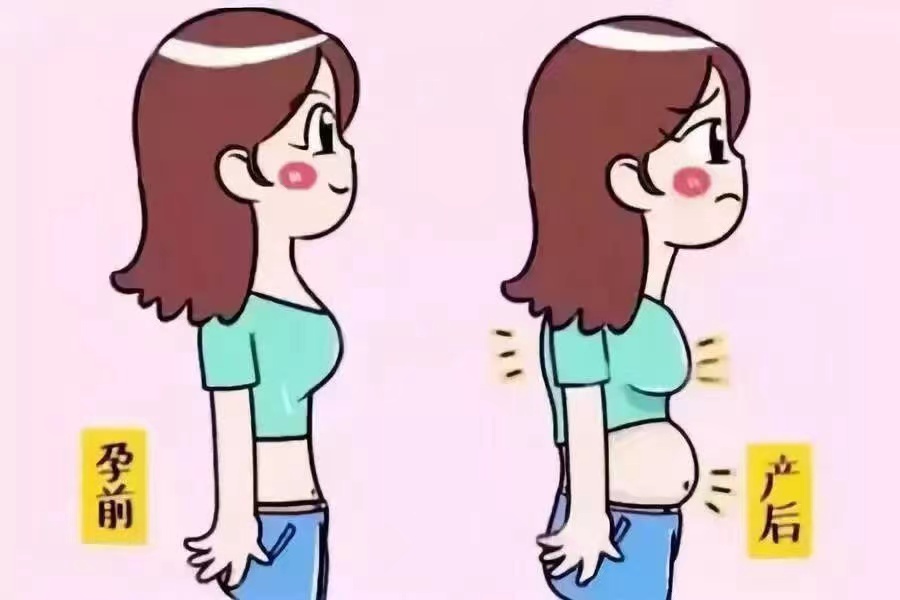产后妈妈腹部肥胖，小心“腹直肌分离”在作怪