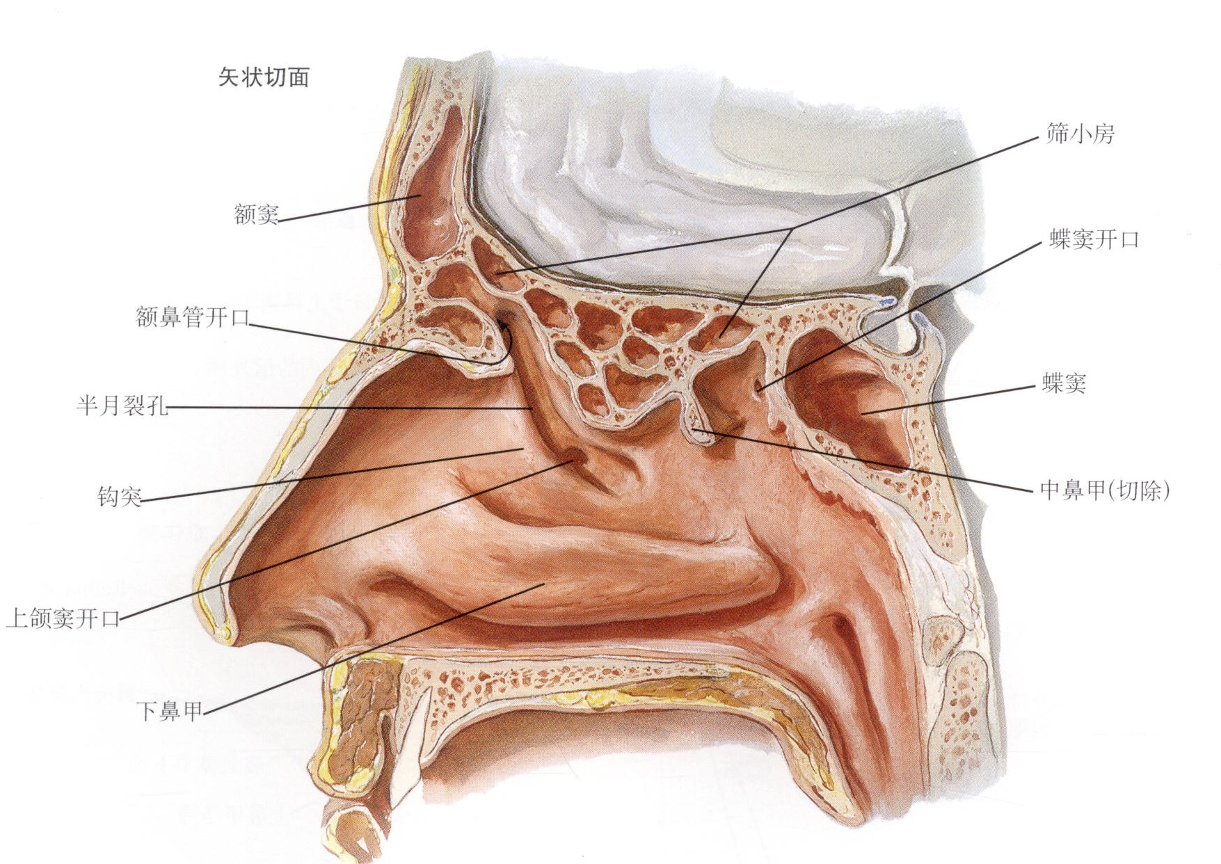 慢性鼻窦炎长期治疗用什么药,慢性鼻窦炎的案例