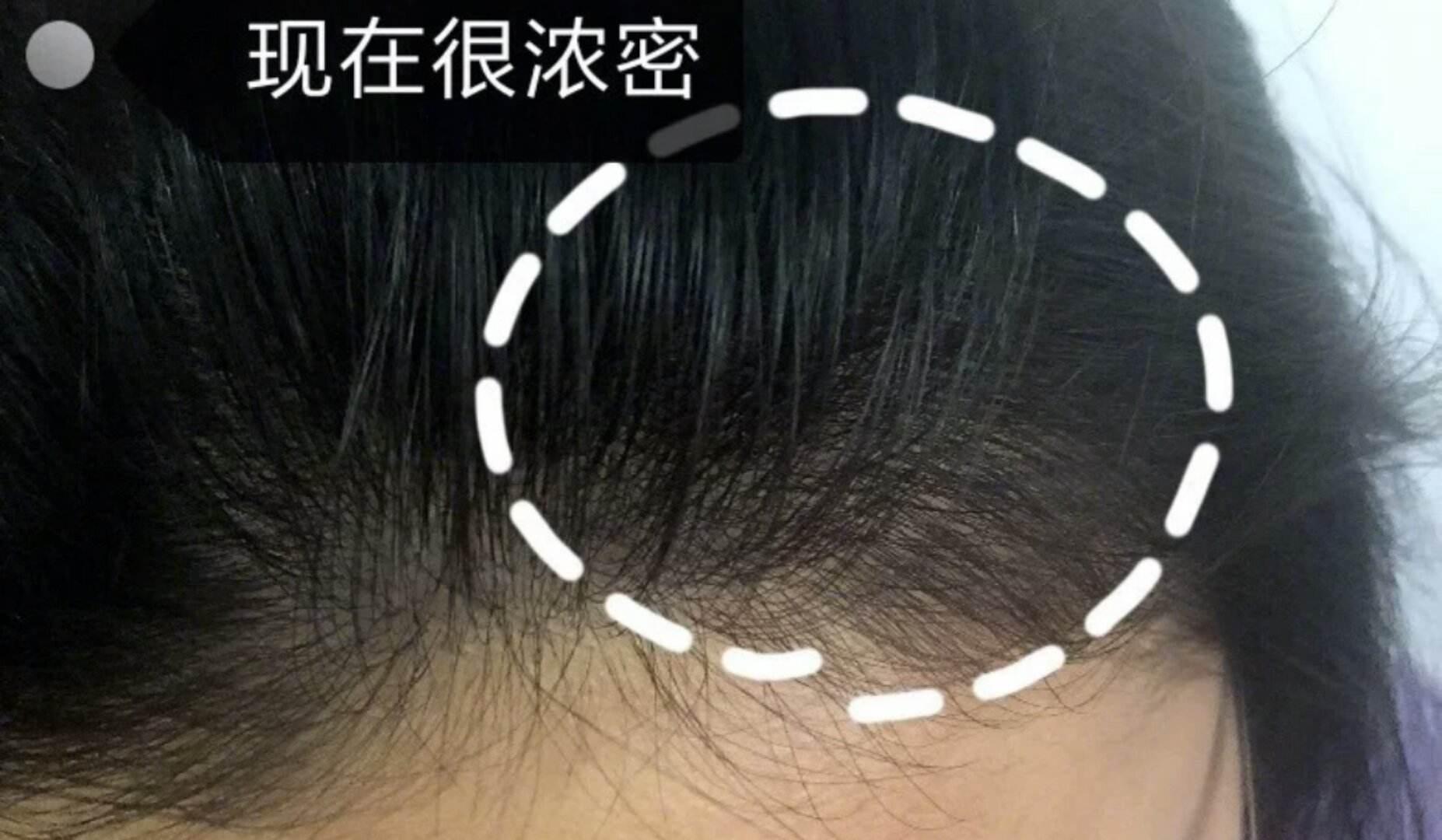 戚薇袁咏仪推荐的洗发水,袁咏仪推荐好用洗发水