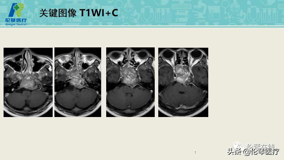 上海教授詹松华,上海曙光医院詹松华简介
