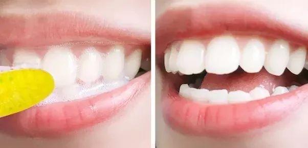 刷牙时一个小窍门彻底告别黄臭牙,刷牙的时候放点小苏打牙会变白吗