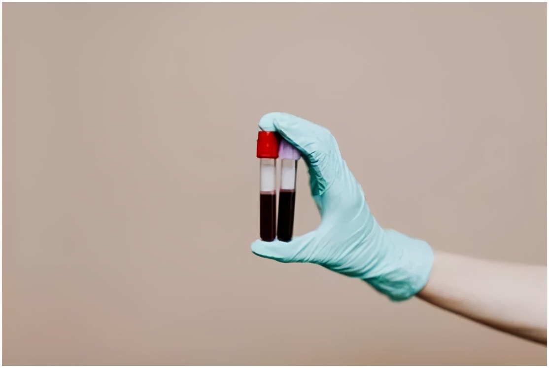 这些炎症可能比癌症更可怕，发病快、致死率高！用好餐桌上的“天然消炎剂”，给身体“消消炎”