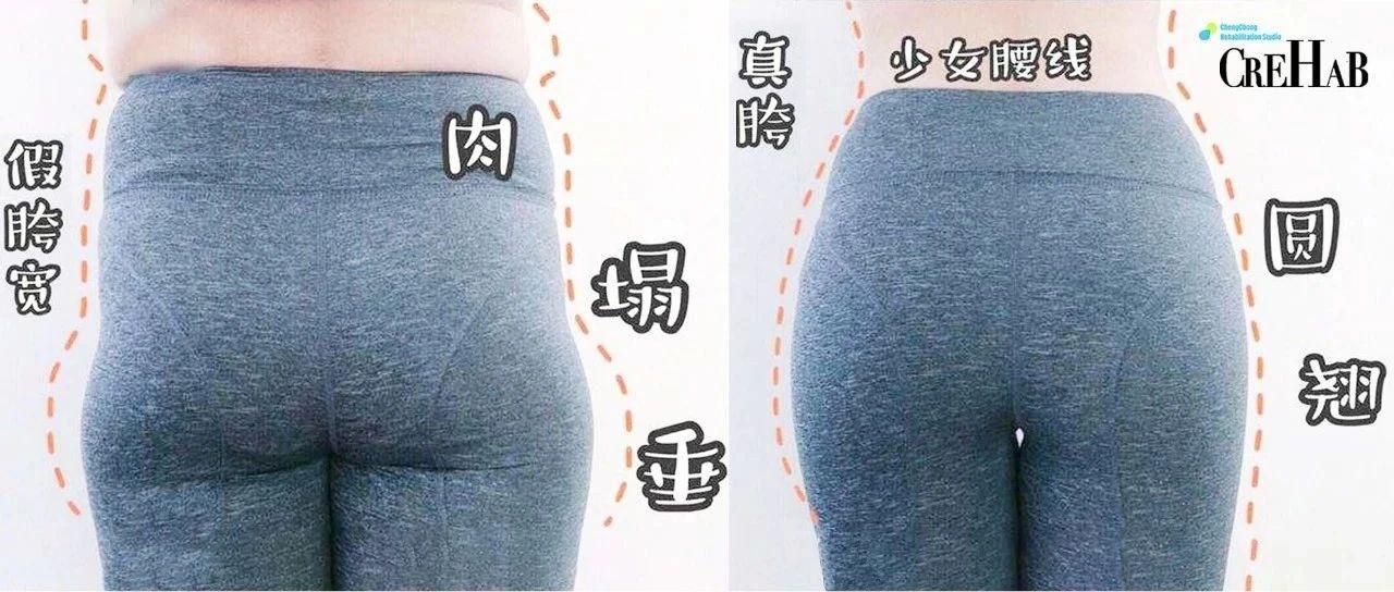 瘦大腿根部内侧和假胯宽的方法,瑜伽改善假胯宽最有效的方法