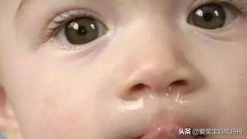 2岁宝宝感冒流鼻涕咳嗽一直流汗,2岁宝宝感冒咳嗽流鼻涕一招解决