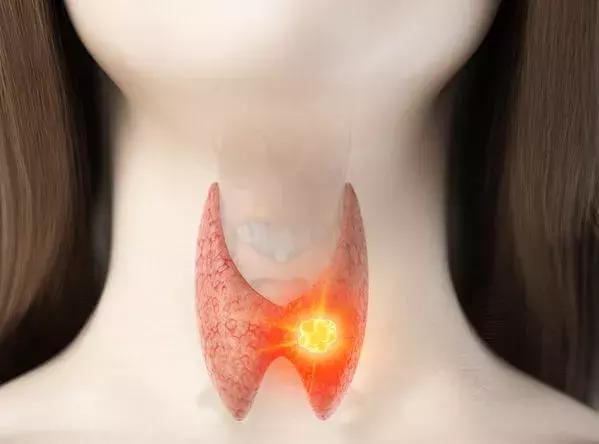 体检查出这10种病基本不用治,华西医院的医生说哪些病不用担心