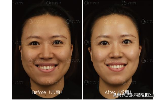 漾格医疗美容怎么样,漾格医美怎么样