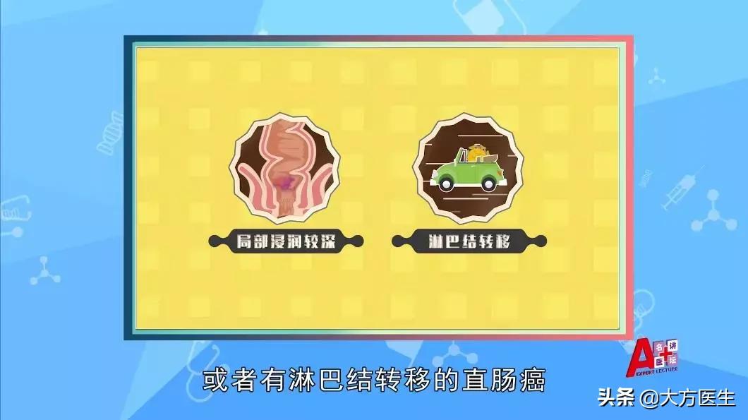 直肠癌保肛术手术方法,直肠癌想保肛可以不用手术治疗吗