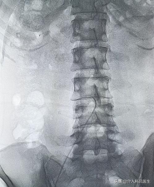 卵巢与子宫调养,女性卵巢和子宫