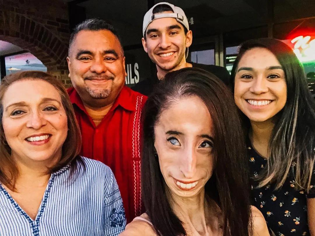 揭秘世界上最丑的女人,世界上最丑的女人背后故事