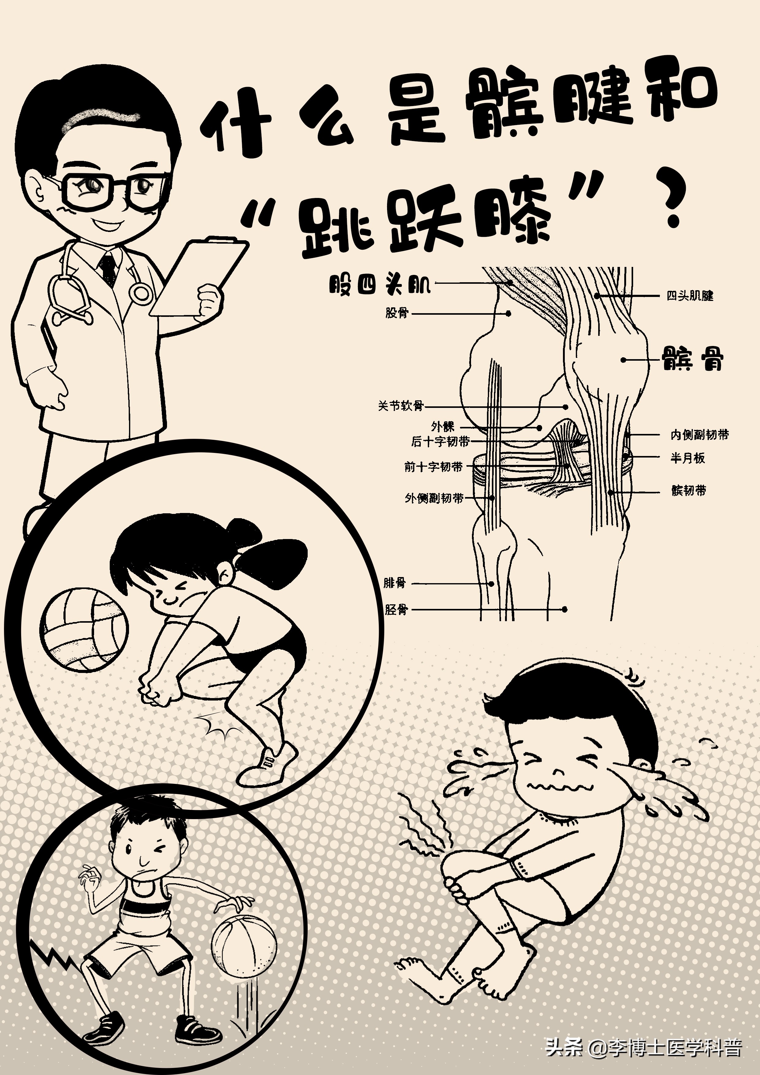 怎样缓解膝盖髌腱炎的疼痛,膝关节疼痛科普视频参赛作品