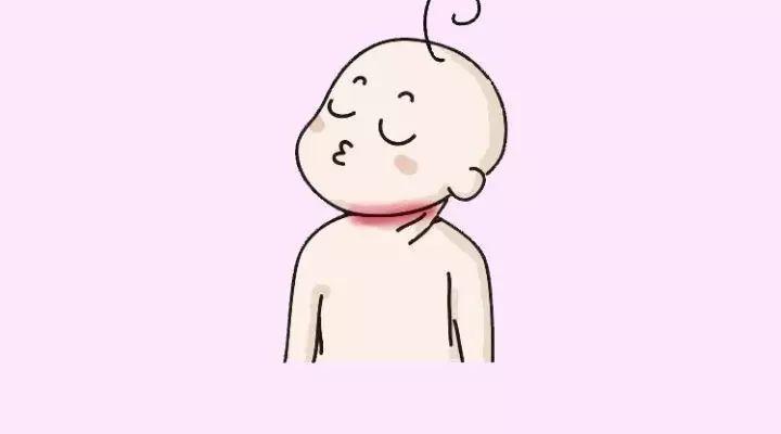 秋季宝宝背出汗怎么处理,易出汗的宝宝该怎样护理